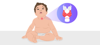 Thumbnail placeholder